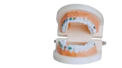 Brackets image Brackets image