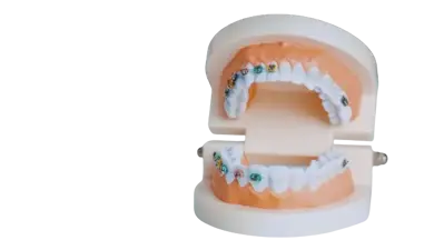 Brackets image Brackets image