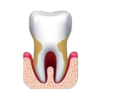 Periodontics image Periodontics image