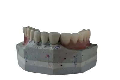 restored dental restored dental