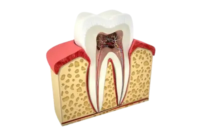 Root canal image Root canal image