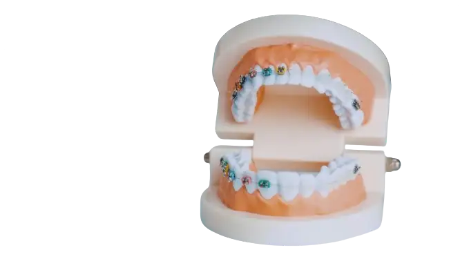 Brackets image