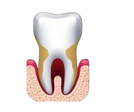 Periodontics image