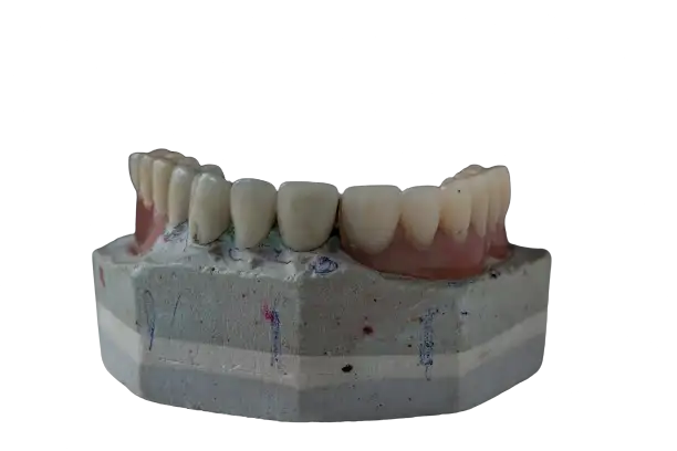 restored dental