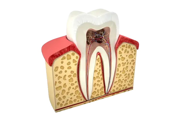 Root canal image